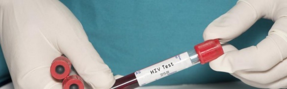 На Черкащині впроваджують швидкі тести на ВІЛ