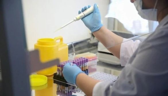 У Черкасах підтвердили 11 випадків інфікування коронавірусом