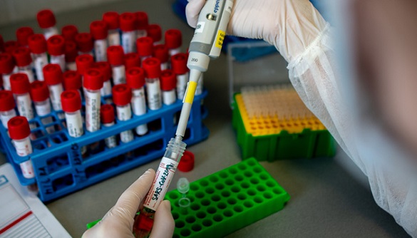 Підозри на коронавірус, які були протягом останньої доби на Черкащині, не підтвердилися