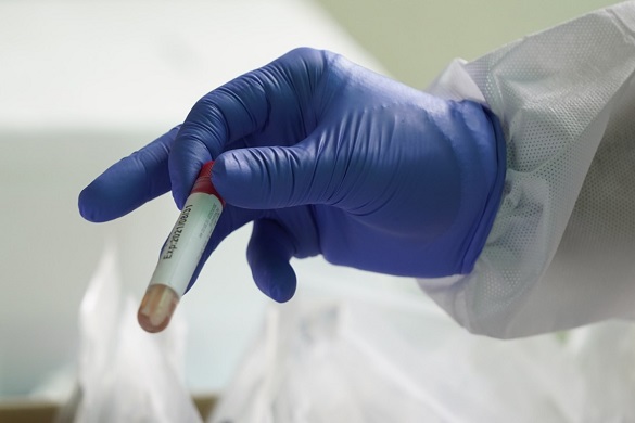За останню добу на Черкащині у чотирьох людей виявили коронавірус