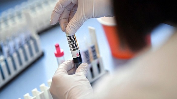 Десять осіб на Черкащині захворіли коронавірусом за добу