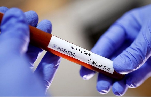 Ще дев'ять людей захворіли коронавірусом на Черкащині за останню добу
