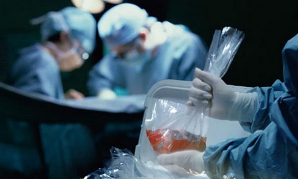 Трансплантацію органів планують проводити у Черкасах