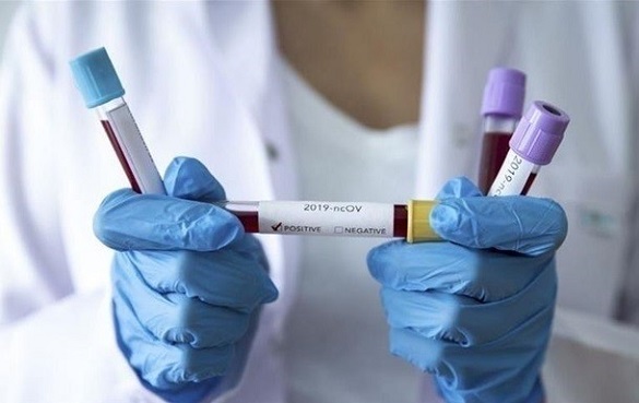 У працівниці одного з департаментів Черкаської ОДА підтвердили коронавірус