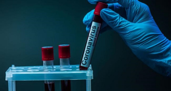 Антирекорд: на Черкащині за останню добу зафіксували 124 нових випадків COVID-19
