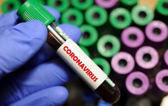 На Черкащині за добу знову понад двісті нових випадків захворюваності на коронавірус