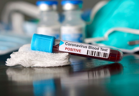 Майже 200 нових випадків захворюваності на коронавірус зафіксували в Черкаській області за останню добу
