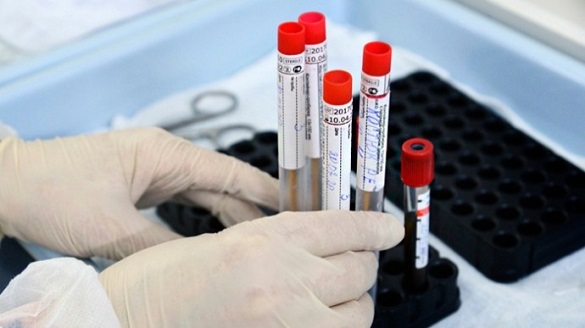 На Черкащині показник захворюваності на коронавірус перевищує базовий у чотири рази