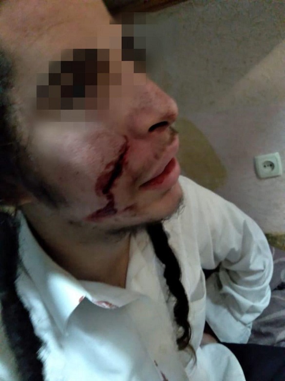 Уманські поліцейські затримали хлопця, який поранив ножем хасида