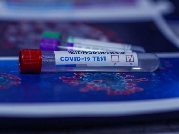 Географія поширення: нові випадки захворюваності на коронавірус у Черкаській області
