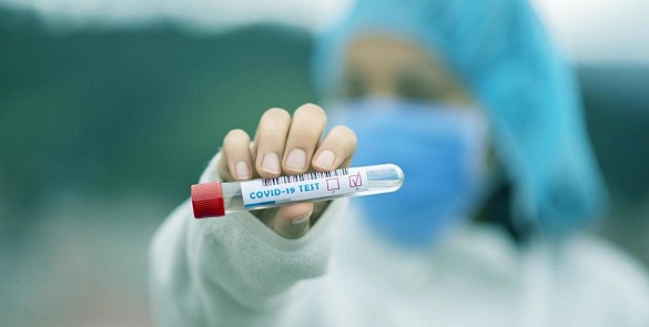 Нові випадки інфікування COVID-19 на Черкащині – 726 хворих за добу