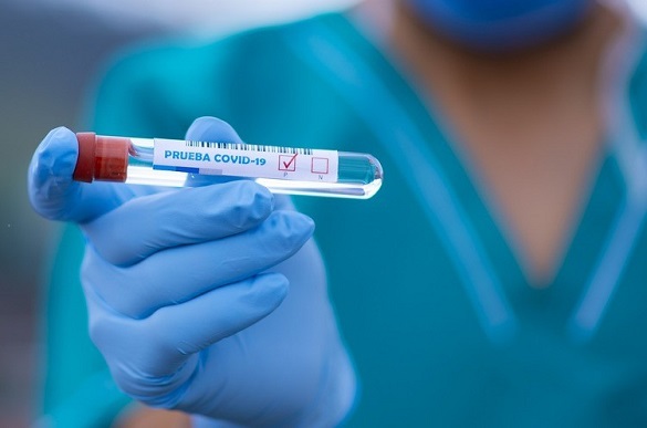 На Черкащині виявили майже 400 нових випадків коронавірусу