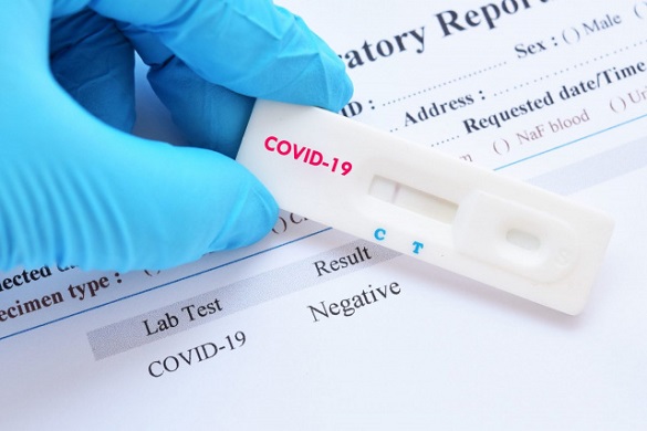 +468 випадків інфікування COVID-19 зафіксували за добу на Черкащині