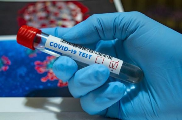+300: на Черкащині зафіксували нові випадки коронавірусу