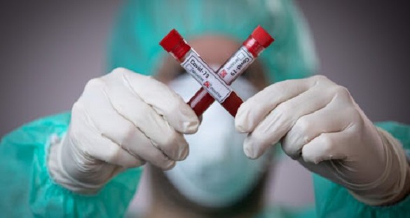 За останню добу на Черкащині померло 9 осіб, які хворіли на коронавірус