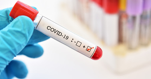 За добу на Черкащині виявили майже двісті нових випадків COVID-19