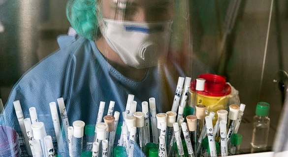 На Черкащині - 280 нових випадків захворювання на коронавірус