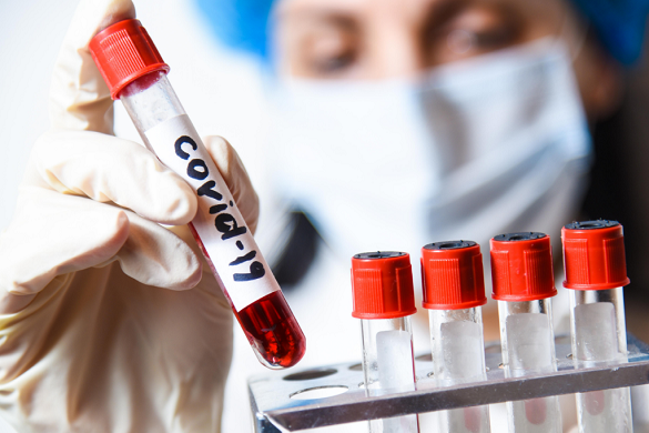 На Черкащині знову зафіксували понад 800 нових випадків коронавірусу