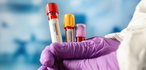 На Черкащині за добу підтвердили 43 випадки коронавірусу
