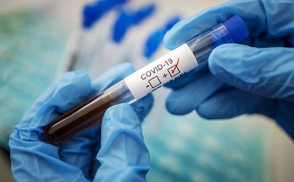На Черкащині за добу зафіксували понад 370 нових випадків COVID-19