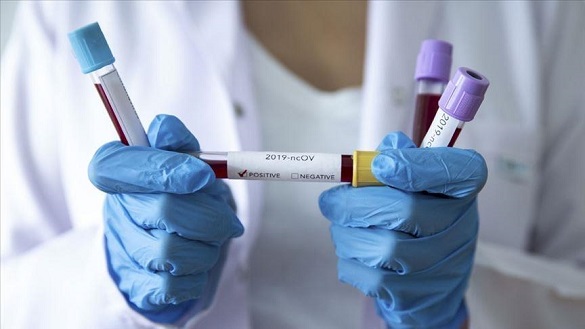 На Черкащині виявили понад 880 нових випадків захворювання на коронавірус