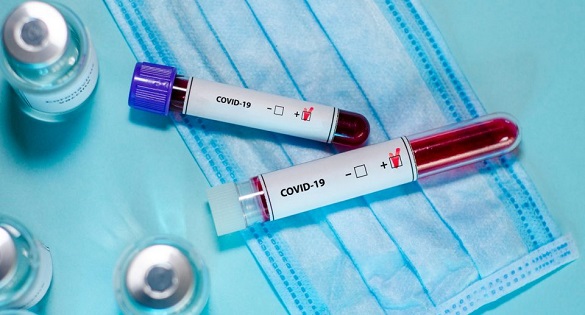 На Черкащині зафіксували 548 нових випадків захворювання на COVID-19