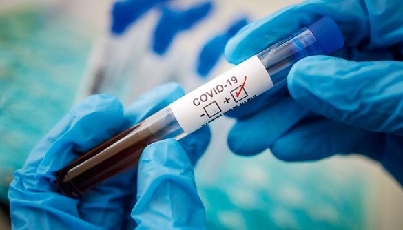 За добу на Черкащині виявили 645 хворих на коронавірус