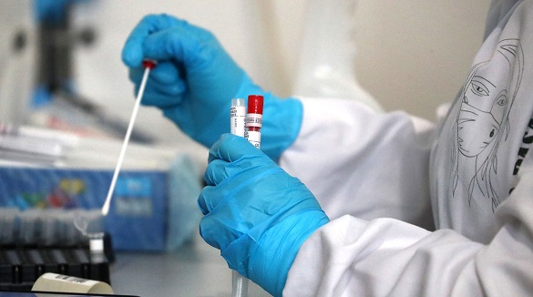 За добу на Черкащині виявили 174 випадків коронавірусу
