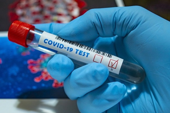 За добу на коронавірус захворіли ще 676 жителів Черкащини