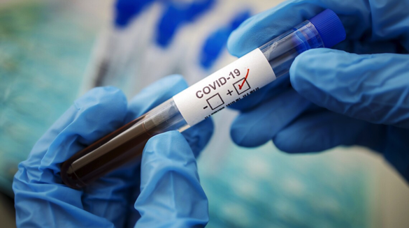 За тиждень на Черкащині померло 5 осіб, у яких був підтверджений коронавірус