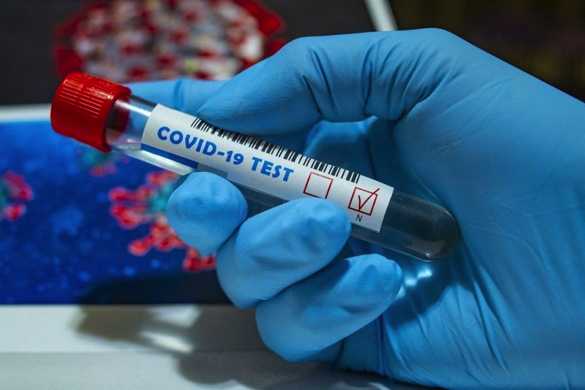 Понад 400 випадків захворювання на коронавірус виявили за тиждень на Черкащині 
