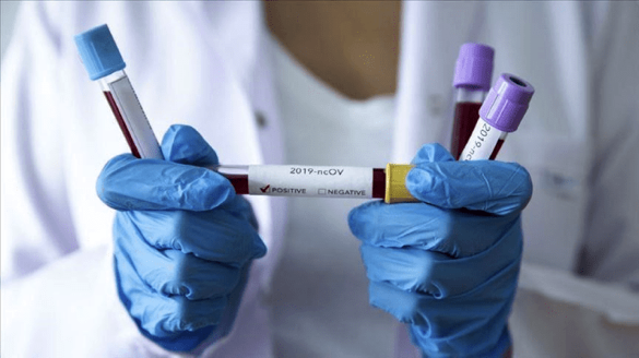 За тиждень на Черкащині виявили 140 випадків інфікування коронавірусом