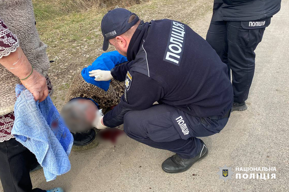 На Черкащині поліцейські рятували пенсіонера, в якого була кровотеча